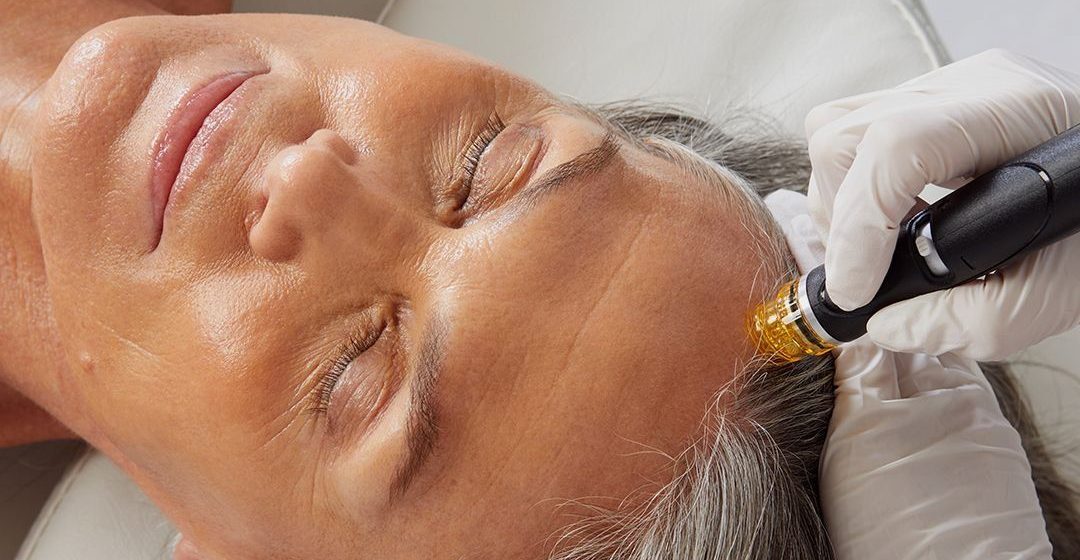 HydraScalp treatment along the hairline
