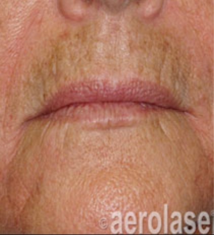 Before & After