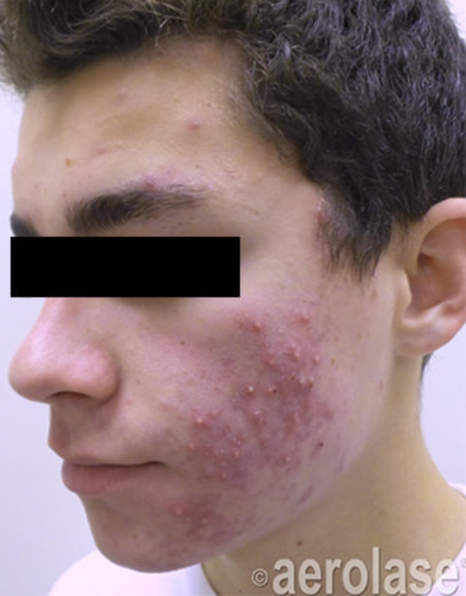 Before & After
