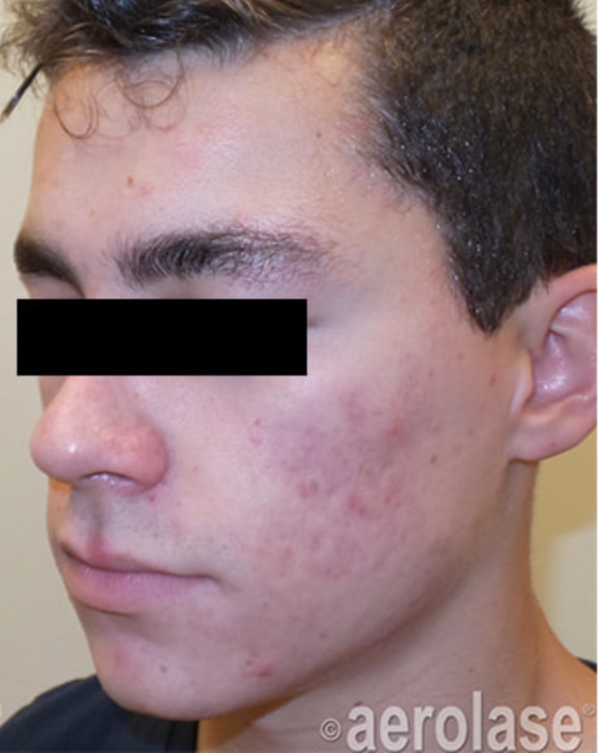 Before & After