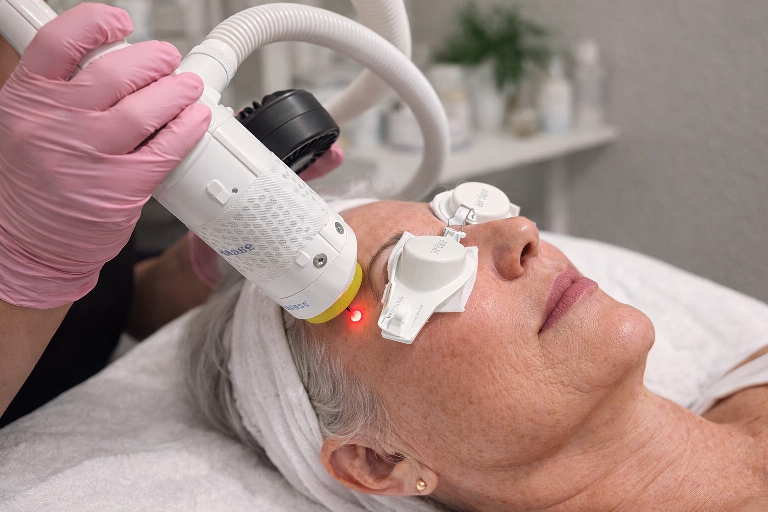 Laser treatment session for skin rejuvenation therapy.