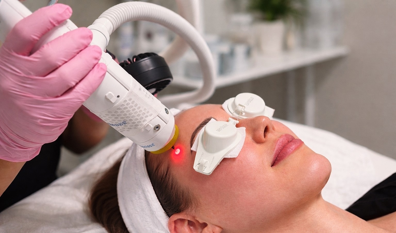 Laser treatment for skin rejuvenation procedure.
