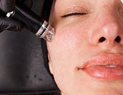 Hydrafacial Benefits: Why This Treatment Is So Popular