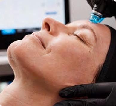 Hydrafacial for Best Results